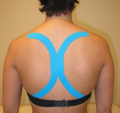 Medical taping
