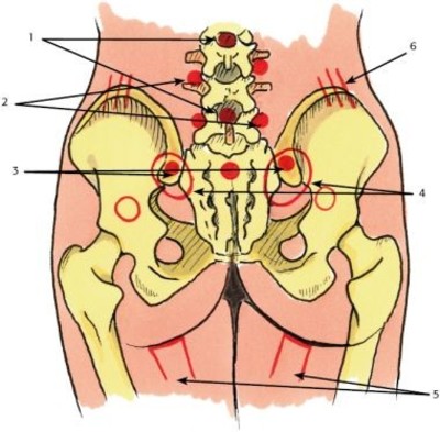 Dornmethode